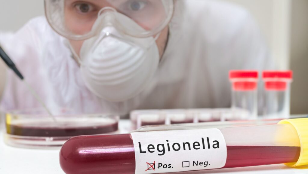 analisi legionella free servizi controllo aria aqua prevenzione rischio legionella